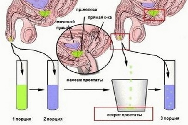 анализ