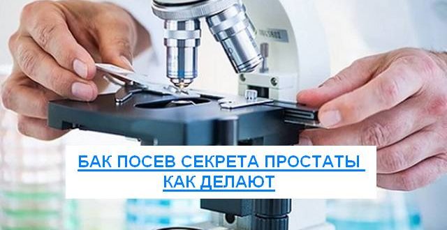 бак посев секрета простаты как делают