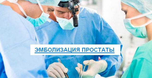 эмболизация простаты