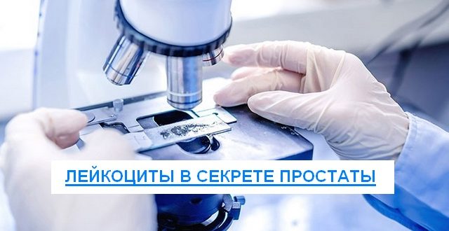 лейкоциты в секрете простаты