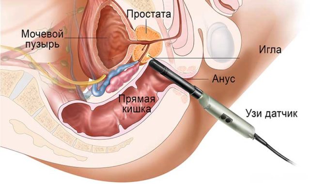 исследование