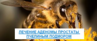 лечение аденомы простаты пчелиным подмором
