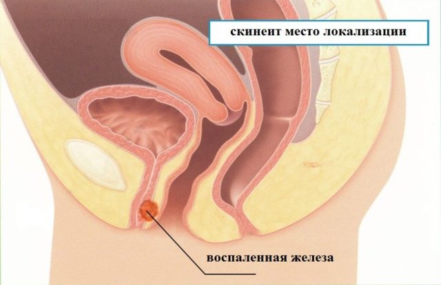 схема