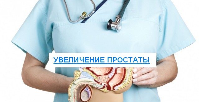 увеличение простаты